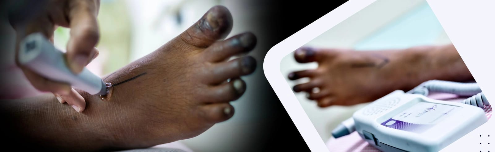 Diabetic Foot & Vascular Care
