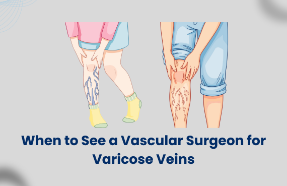 When to See a Vascular Surgeon for Varicose Veins